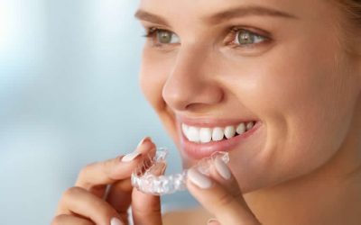 Ortodonzia / Invisalign